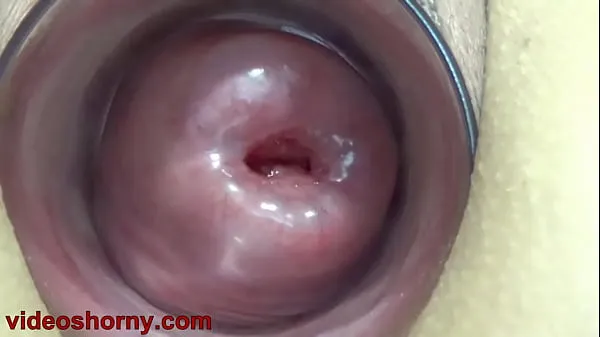 Fresh Cervix Fucking pumped uterus prolapsed and t.. b. a. pussy and tormented mega Clips
