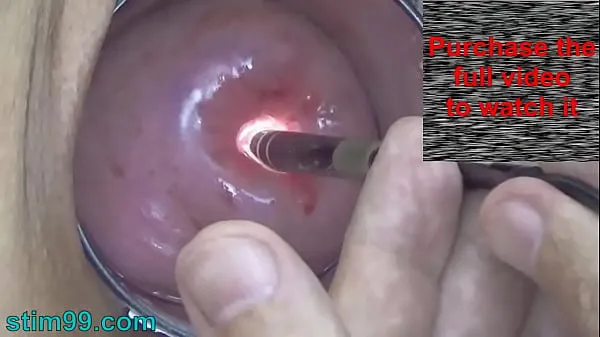 Fresh Endoscopic Camera in Cervix watch inside my Womb and Vagina. Inspection testing exam of wife by extreme doctor gynecologist mega Clips