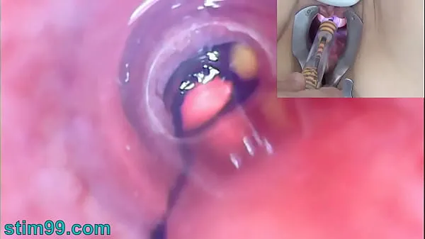 Fresh Mature Woman Peehole Endoscope Camera in Bladder with Balls mega Clips